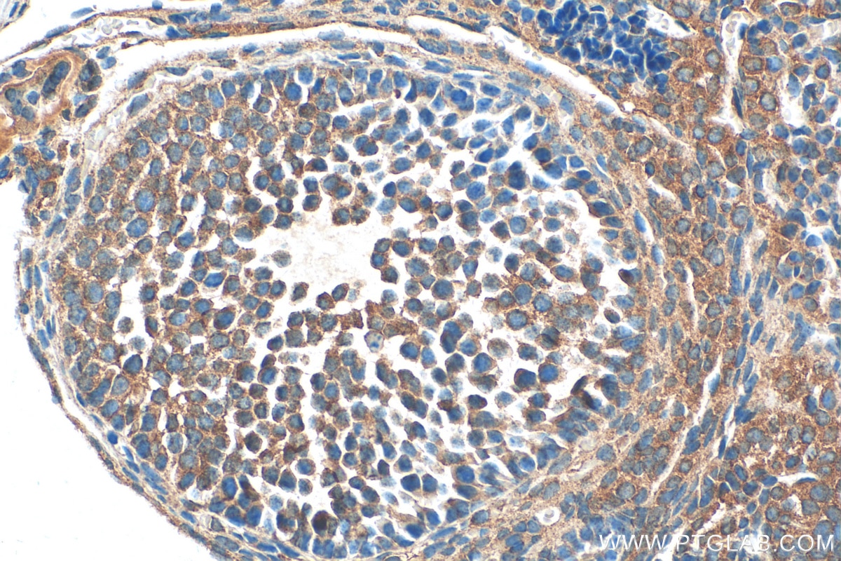 Immunohistochemistry (IHC) staining of mouse ovary tissue using KIAA1109 Polyclonal antibody (26349-1-AP)