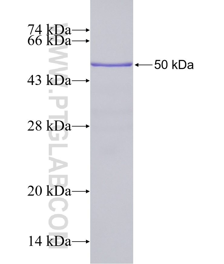 KIAA1109 fusion protein Ag23625 SDS-PAGE