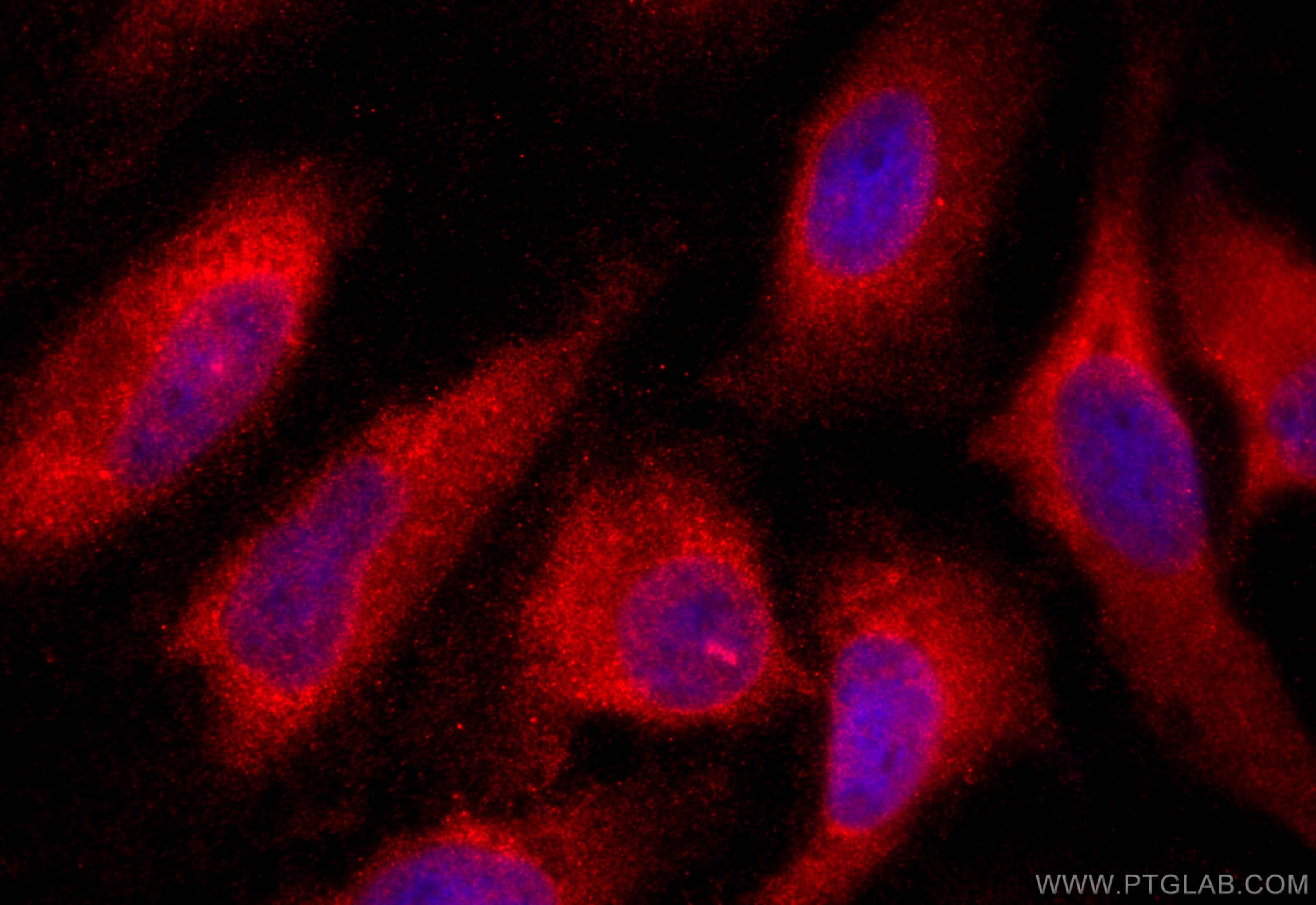 Immunofluorescence (IF) / fluorescent staining of HeLa cells using KIAA1191 Polyclonal antibody (20637-1-AP)