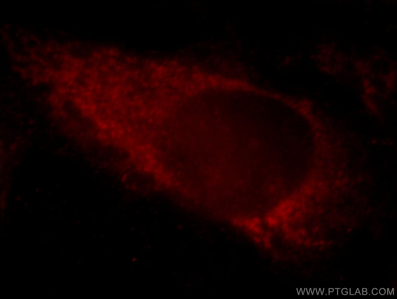 Immunofluorescence (IF) / fluorescent staining of HeLa cells using KIAA1191 Polyclonal antibody (20637-1-AP)