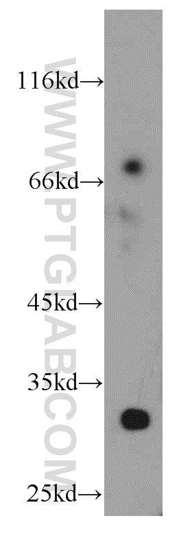 Western Blot (WB) analysis of mouse ovary tissue using KIAA1191 Polyclonal antibody (20637-1-AP)