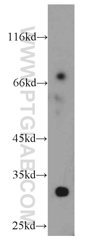 WB analysis of mouse ovary using 20637-1-AP