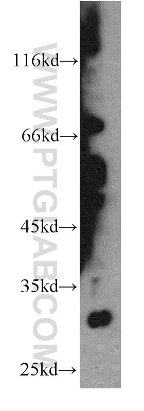 Western Blot (WB) analysis of mouse uterus tissue using KIAA1191 Polyclonal antibody (20637-1-AP)