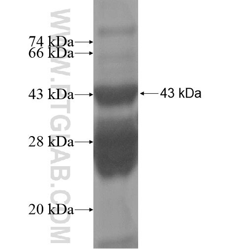 KIAA1191 fusion protein Ag14694 SDS-PAGE