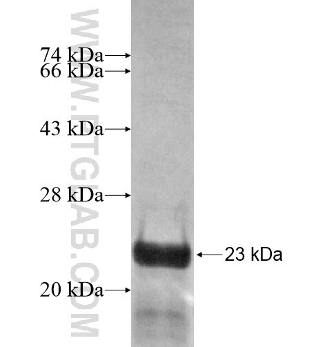 KIAA1191 fusion protein Ag15150 SDS-PAGE