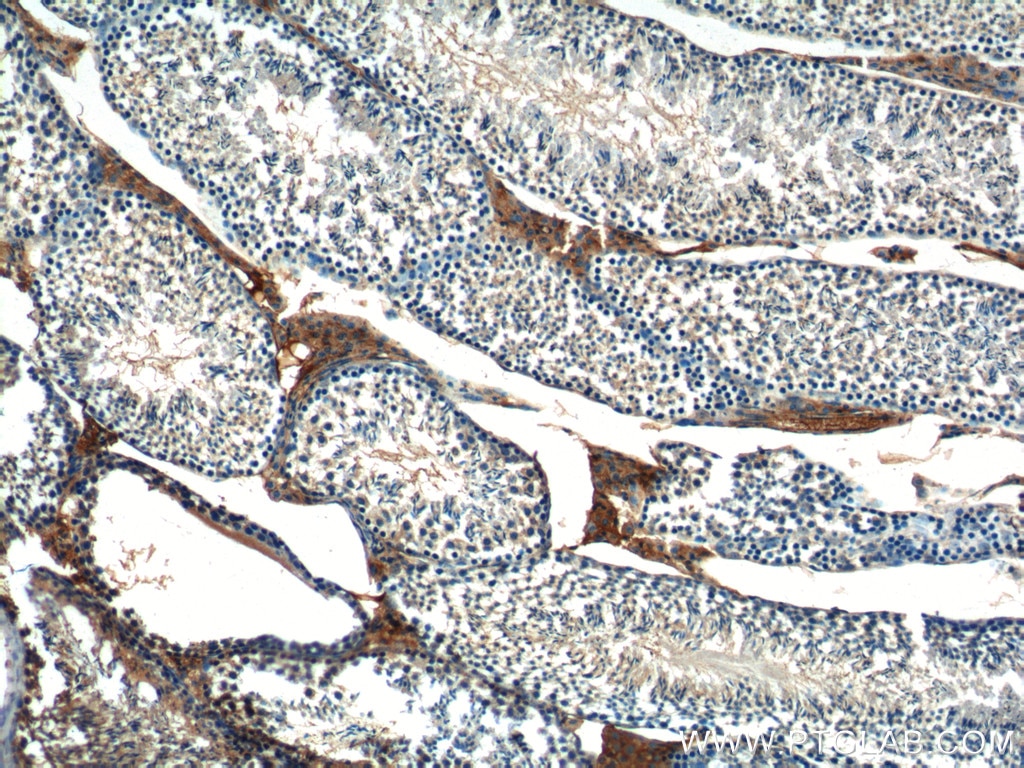 Immunohistochemistry (IHC) staining of mouse testis tissue using KIAA1199 / CEMIP  Polyclonal antibody (21129-1-AP)