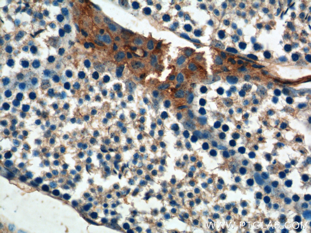 Immunohistochemistry (IHC) staining of mouse testis tissue using KIAA1199 / CEMIP  Polyclonal antibody (21129-1-AP)