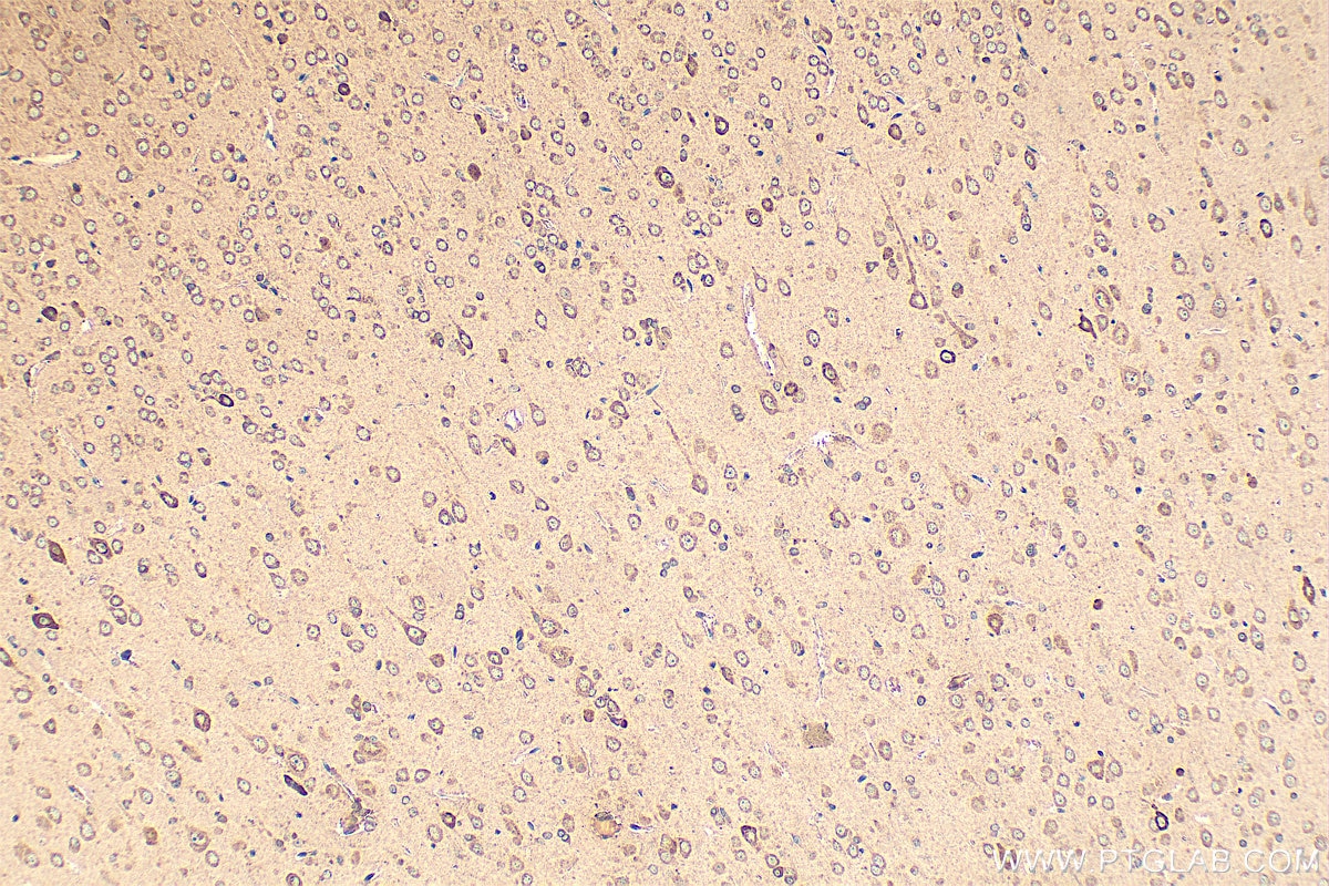 Immunohistochemistry (IHC) staining of rat brain tissue using KIAA1199 / CEMIP  Polyclonal antibody (21129-1-AP)