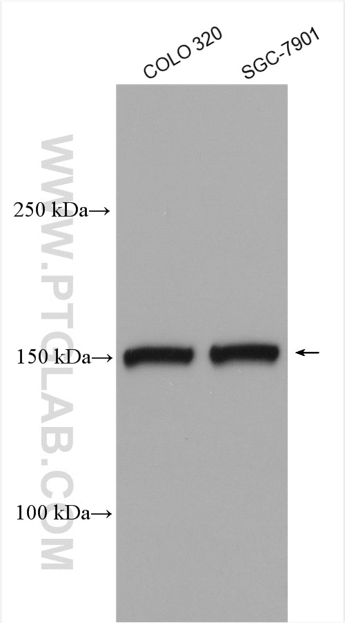 Western Blot (WB) analysis of various lysates using KIAA1199 / CEMIP  Polyclonal antibody (21129-1-AP)