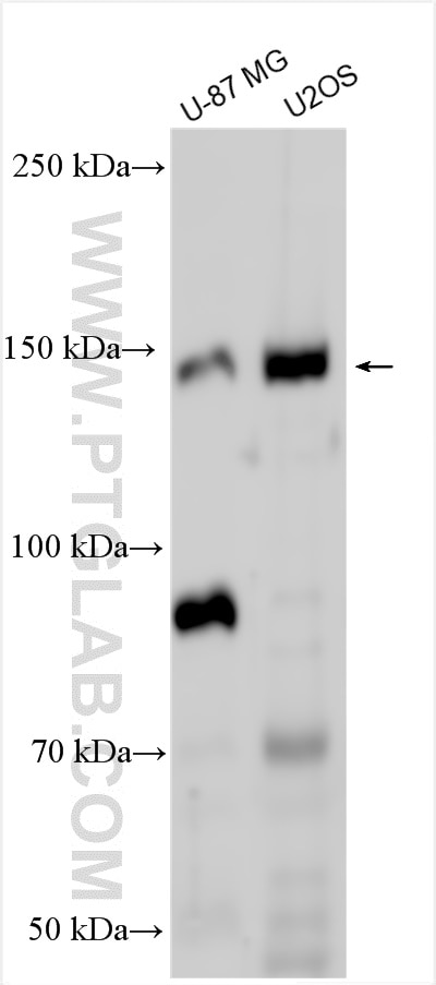 Western Blot (WB) analysis of various lysates using KIAA1199 / CEMIP  Polyclonal antibody (21129-1-AP)
