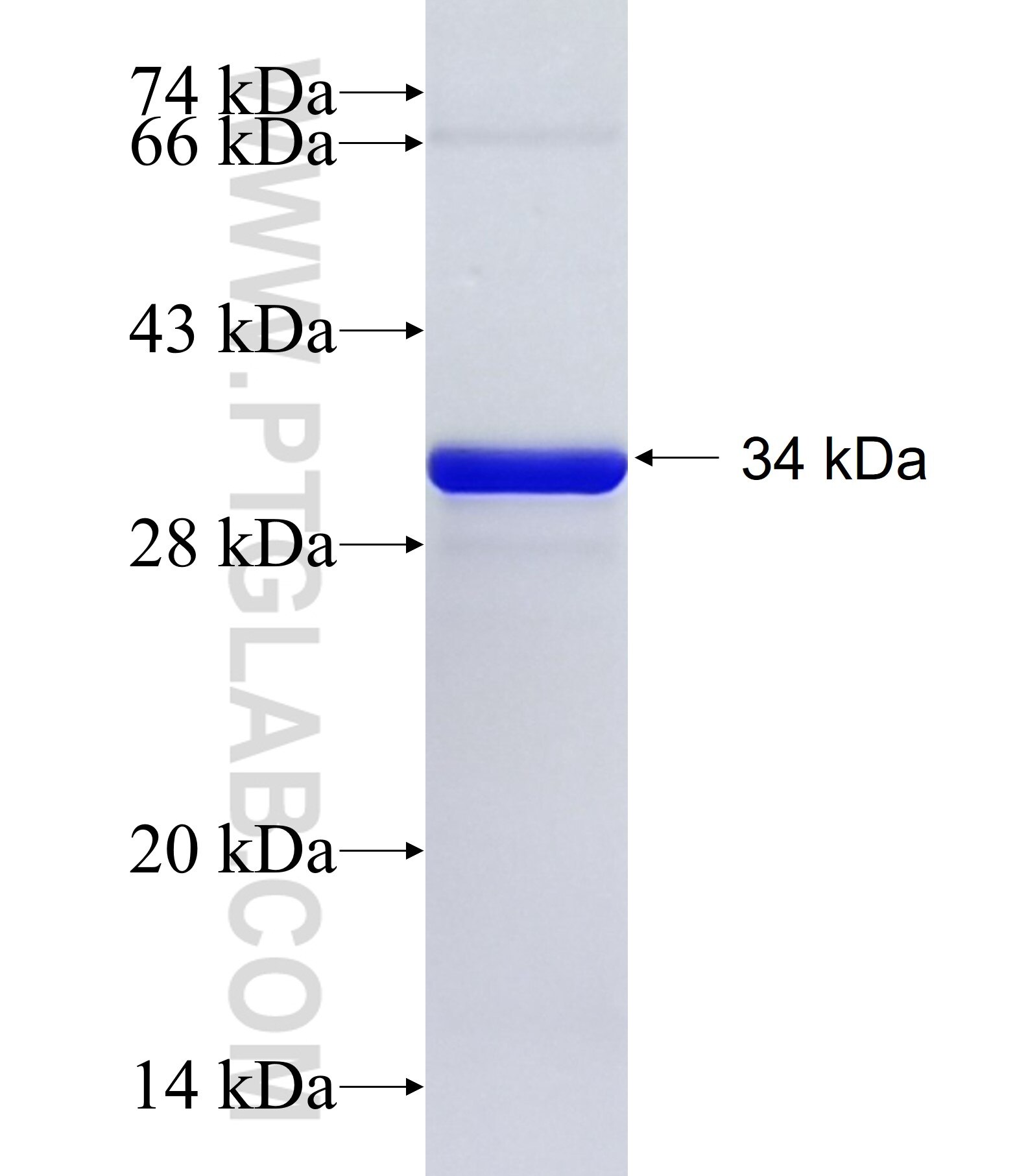 KIAA1199 fusion protein Ag34336 SDS-PAGE KIAA1199 fusion protein Ag34336 SDS-PAGE