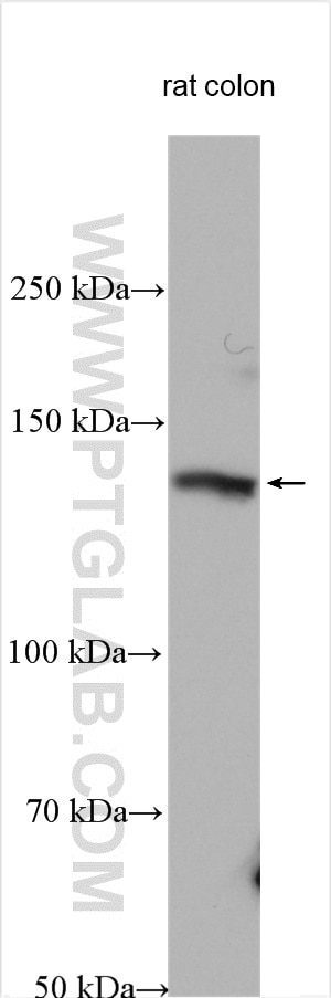 Western Blot (WB) analysis of various lysates using KIAA1217 Polyclonal antibody (24880-1-AP)