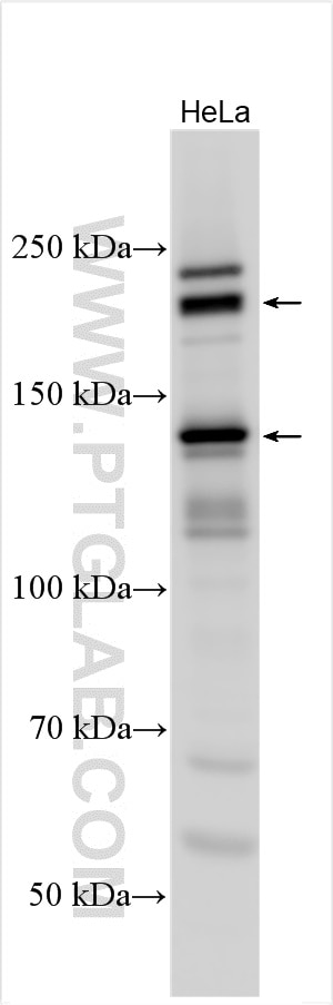 Western Blot (WB) analysis of various lysates using KIAA1217 Polyclonal antibody (24880-1-AP)