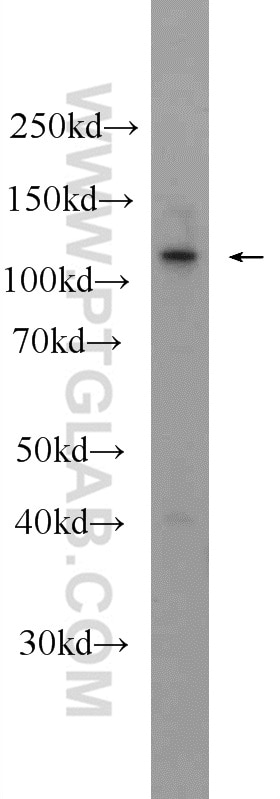 Western Blot (WB) analysis of mouse colon tissue using KIAA1217 Polyclonal antibody (24880-1-AP)