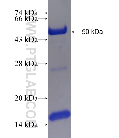 KIAA1217 fusion protein Ag19367 SDS-PAGE