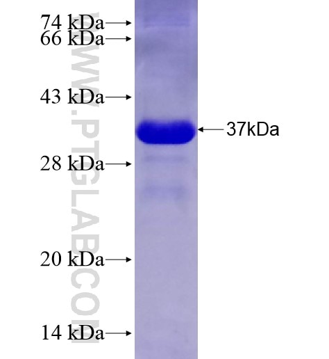KIAA1219 fusion protein Ag28259 SDS-PAGE