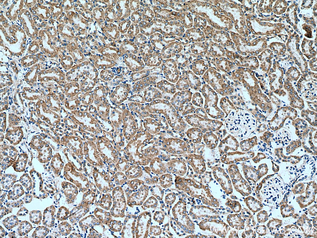 Immunohistochemistry (IHC) staining of mouse kidney tissue using KIAA1279 Polyclonal antibody (25653-1-AP)