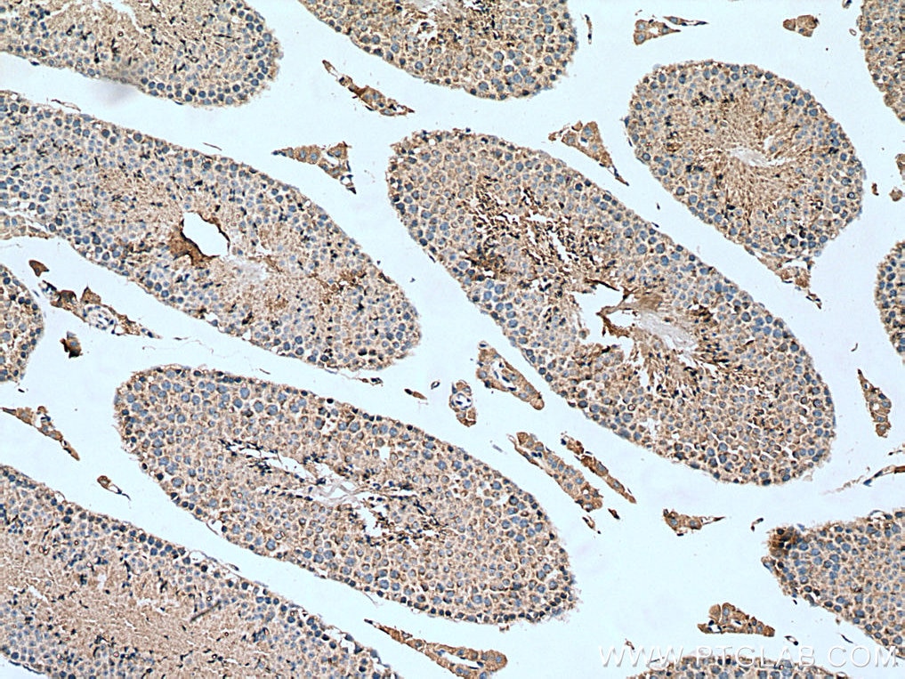 Immunohistochemistry (IHC) staining of mouse testis tissue using KIAA1279 Polyclonal antibody (25653-1-AP)