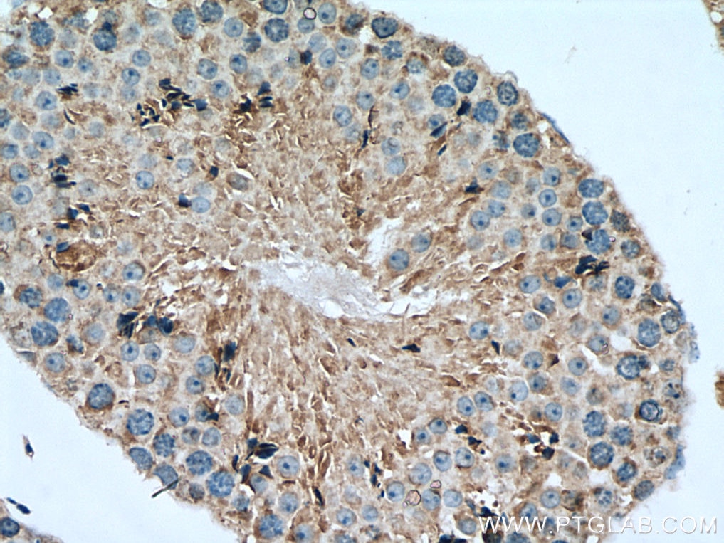 Immunohistochemistry (IHC) staining of mouse testis tissue using KIAA1279 Polyclonal antibody (25653-1-AP)