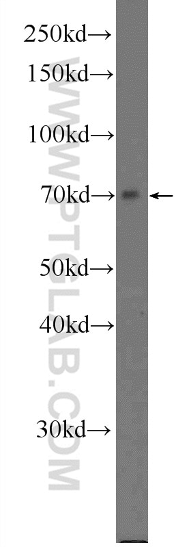 Western Blot (WB) analysis of mouse kidney tissue using KIAA1279 Polyclonal antibody (25653-1-AP)