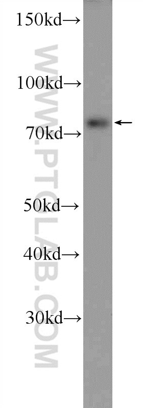 Western Blot (WB) analysis of HEK-293 cells using KIAA1279 Polyclonal antibody (25653-1-AP)