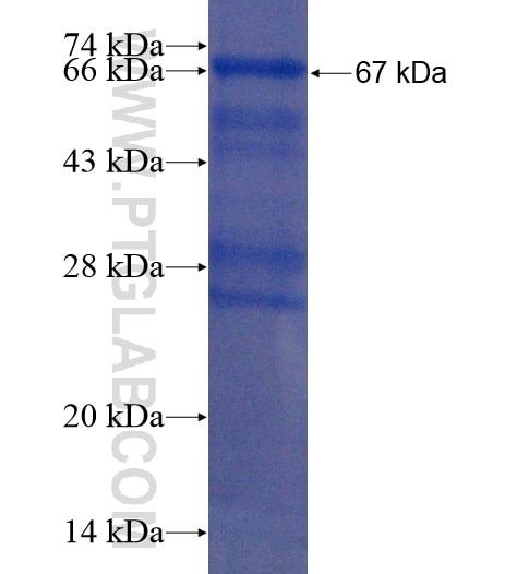 KIAA1279 fusion protein Ag22234 SDS-PAGE