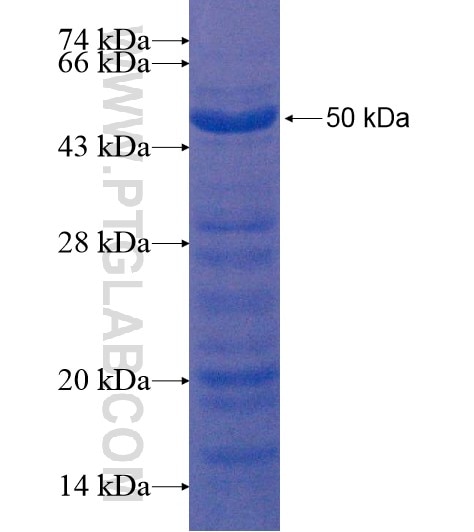 KIAA1310 fusion protein Ag22117 SDS-PAGE