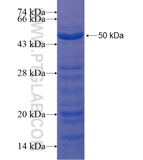 KIAA1310 fusion protein Ag22117 SDS-PAGE