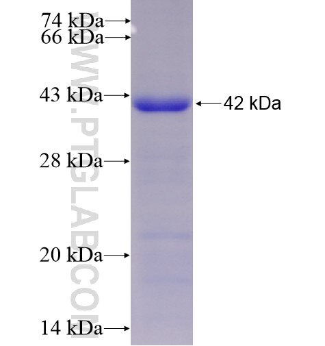 KIAA1324 fusion protein Ag15426 SDS-PAGE