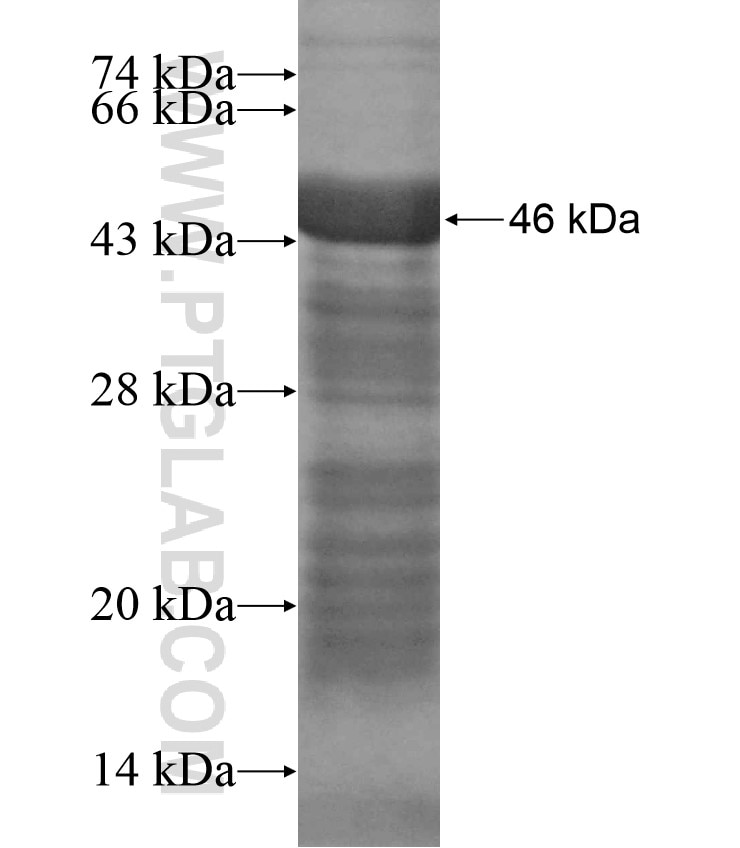 KIAA1370 fusion protein Ag17374 SDS-PAGE
