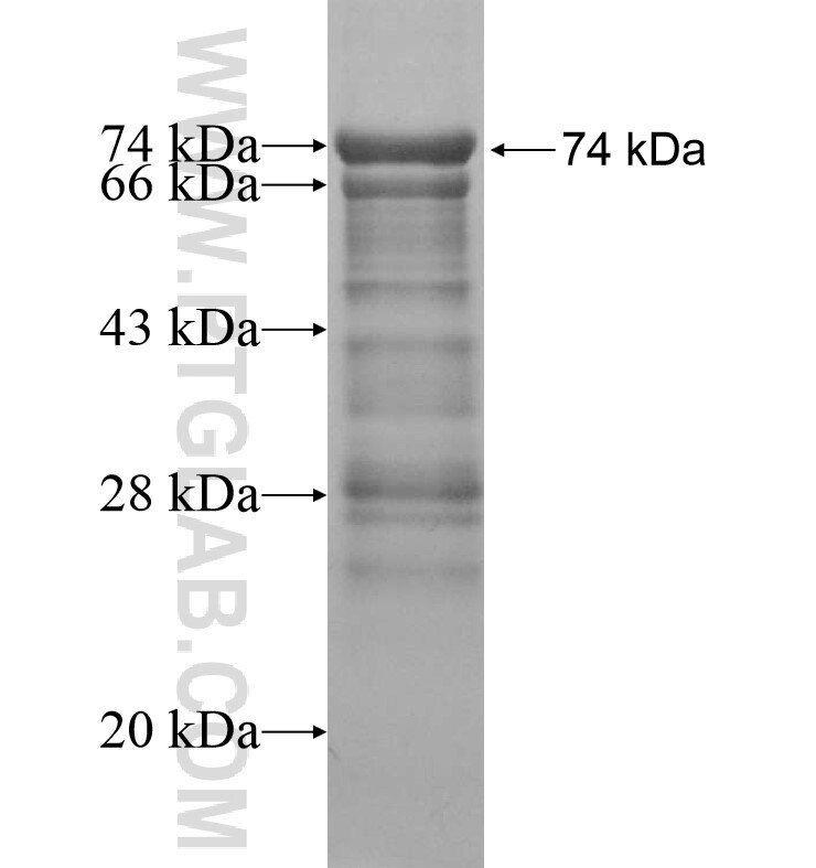 KIAA1383 fusion protein Ag16447 SDS-PAGE