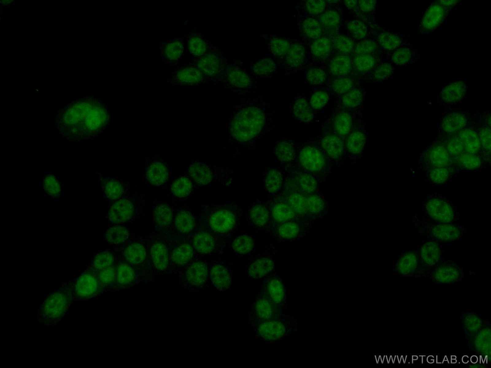 Immunofluorescence (IF) / fluorescent staining of MCF-7 cells using VIRMA/KIAA1429 Polyclonal antibody (25712-1-AP)