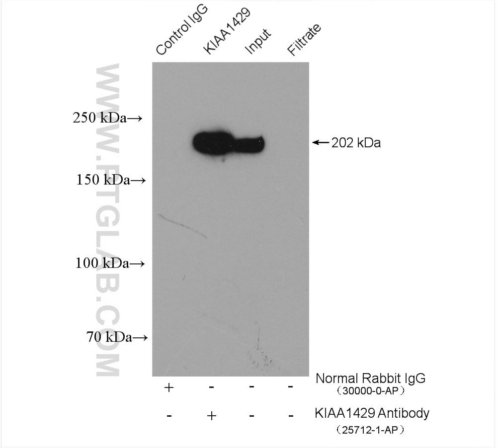 Immunoprecipitation (IP) experiment of MCF-7 cells using VIRMA/KIAA1429 Polyclonal antibody (25712-1-AP)