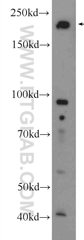 VIRMA/KIAA1429