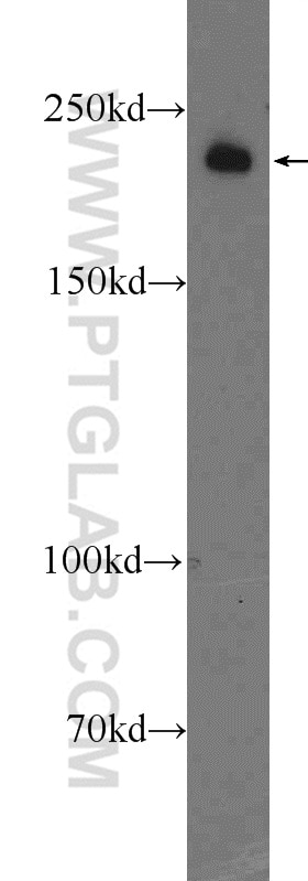 WB analysis of PC-3 using 25712-1-AP