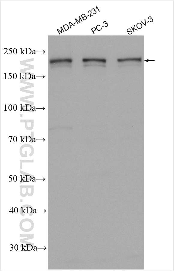 Western Blot (WB) analysis of various lysates using VIRMA/KIAA1429 Polyclonal antibody (25712-1-AP)