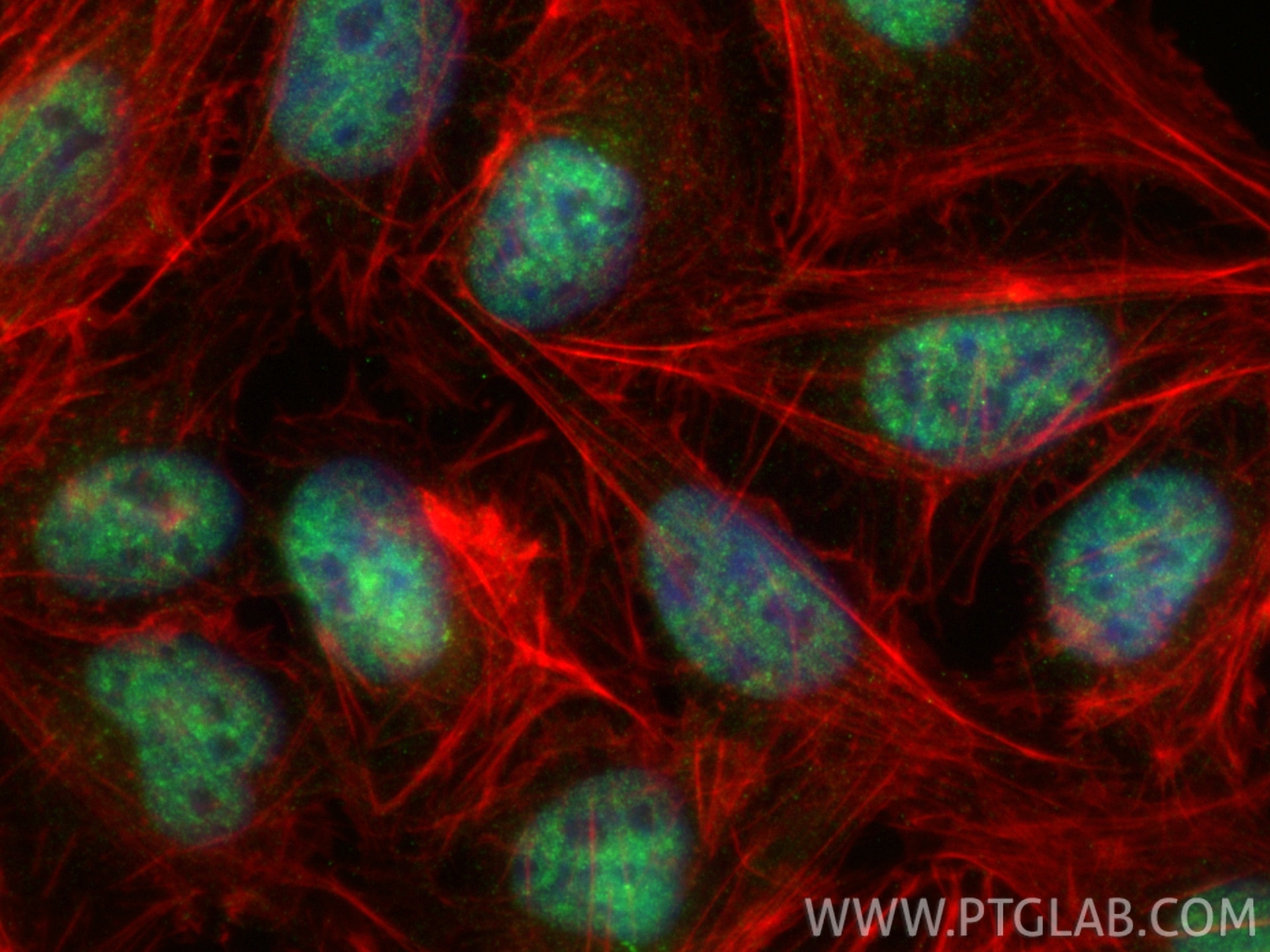 Immunofluorescence (IF) / fluorescent staining of U2OS cells using VIRMA/KIAA1429 Polyclonal antibody (30166-1-AP)