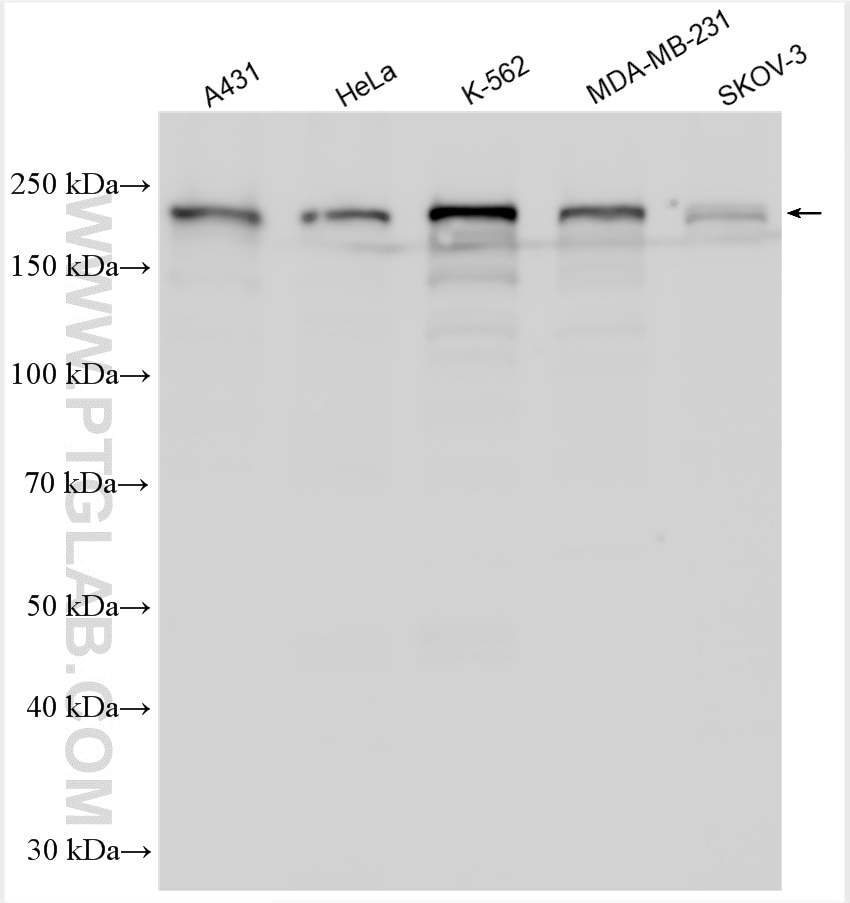 Western Blot (WB) analysis of various lysates using KIAA1429 Polyclonal antibody (30166-1-AP)