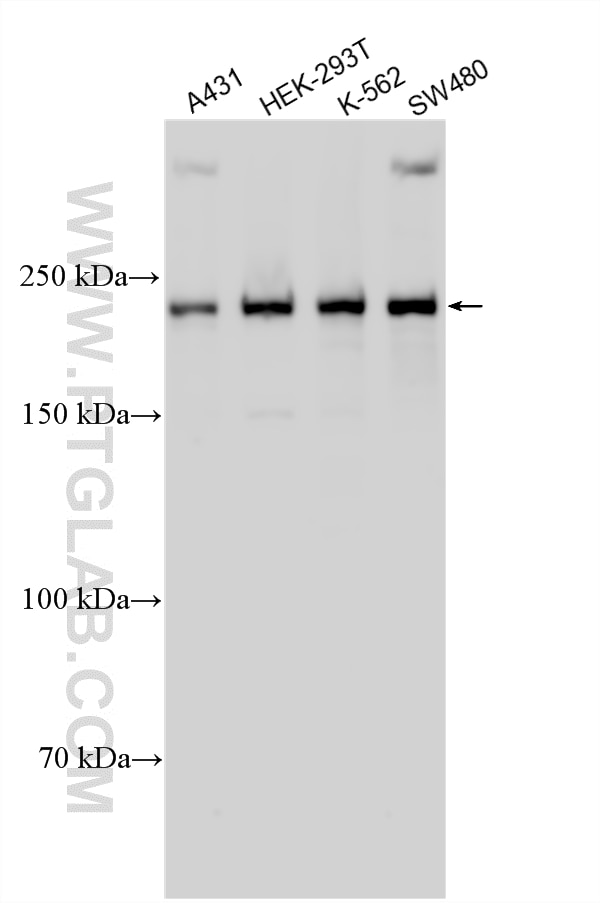 Western Blot (WB) analysis of various lysates using VIRMA/KIAA1429 Polyclonal antibody (30166-1-AP)