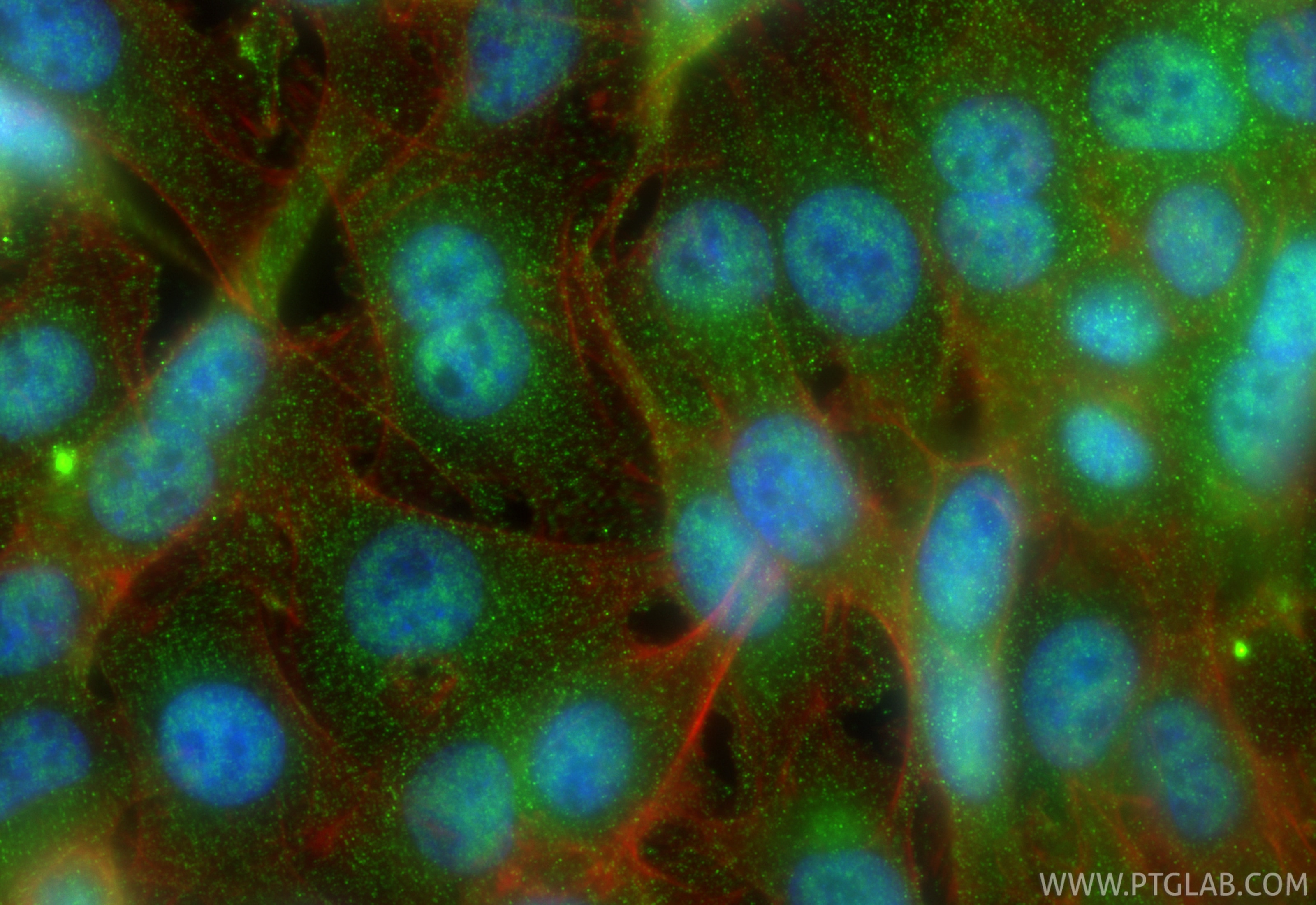Immunofluorescence (IF) / fluorescent staining of SW480 cells using KIAA1429 Monoclonal antibody (68235-1-Ig)