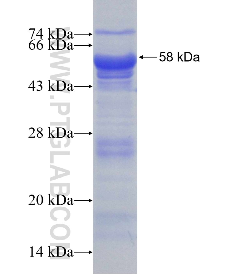KIAA1429 fusion protein Ag22449 SDS-PAGE
