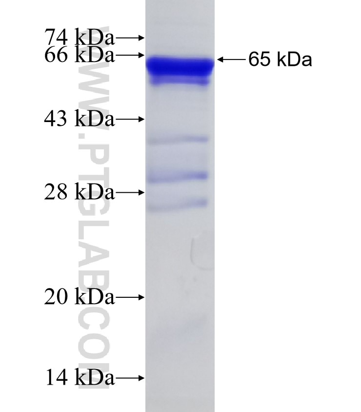 KIAA1429 fusion protein Ag32830 SDS-PAGE