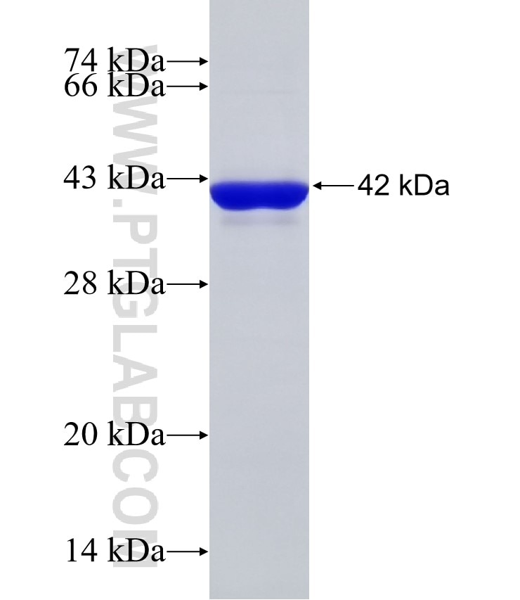 KIAA1429 fusion protein Ag32849 SDS-PAGE KIAA1429 fusion protein Ag32849 SDS-PAGE