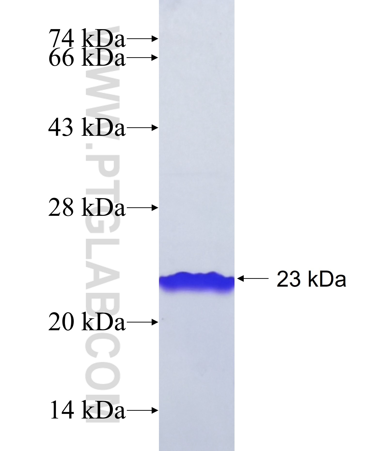 KIAA1429 fusion protein Ag39128 SDS-PAGE KIAA1429 fusion protein Ag39128 SDS-PAGE