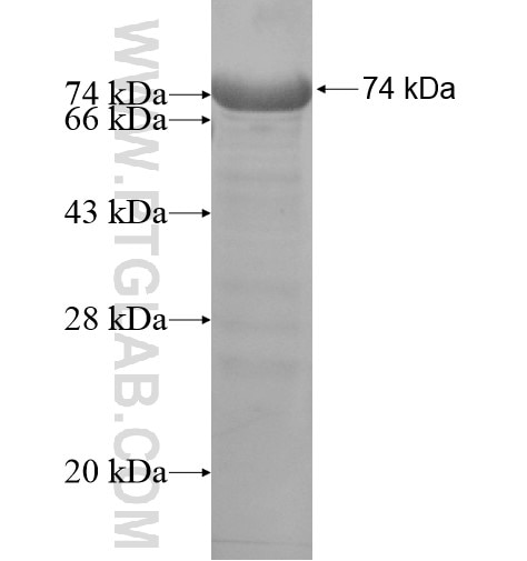 KIAA1430 fusion protein Ag15478 SDS-PAGE