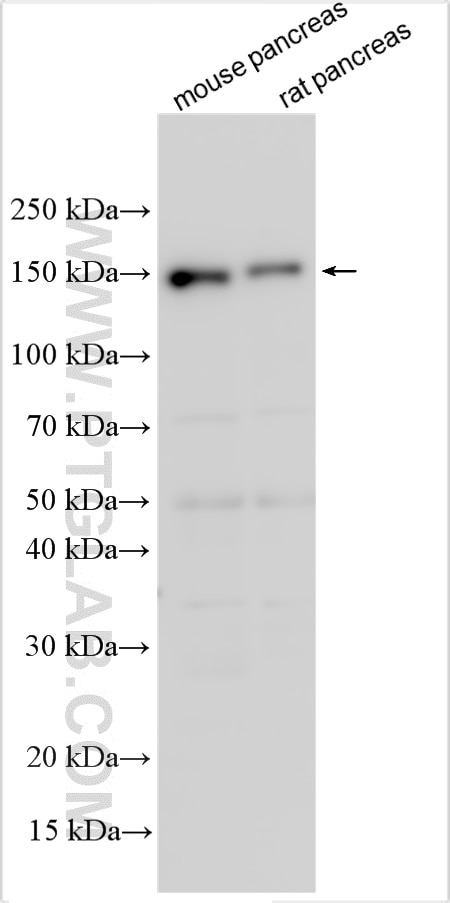 WB analysis using 32377-1-AP Western Blot (WB) analysis of various lysates using KIAA1432 Polyclonal antibody (32377-1-AP)
