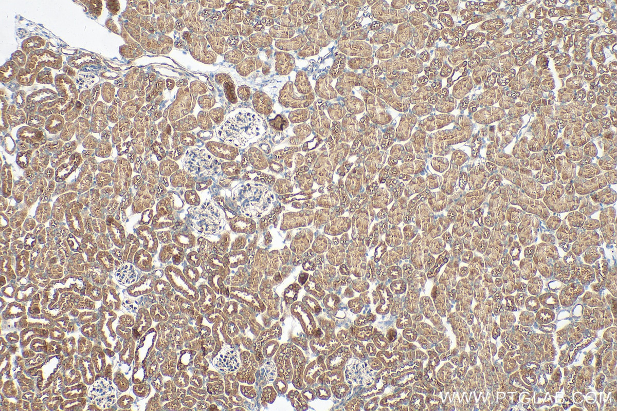 Immunohistochemistry (IHC) staining of mouse kidney tissue using KIAA1468 Polyclonal antibody (18993-1-AP)