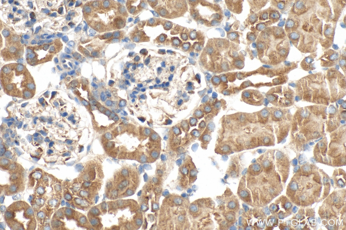 Immunohistochemistry (IHC) staining of mouse kidney tissue using KIAA1468 Polyclonal antibody (18993-1-AP)