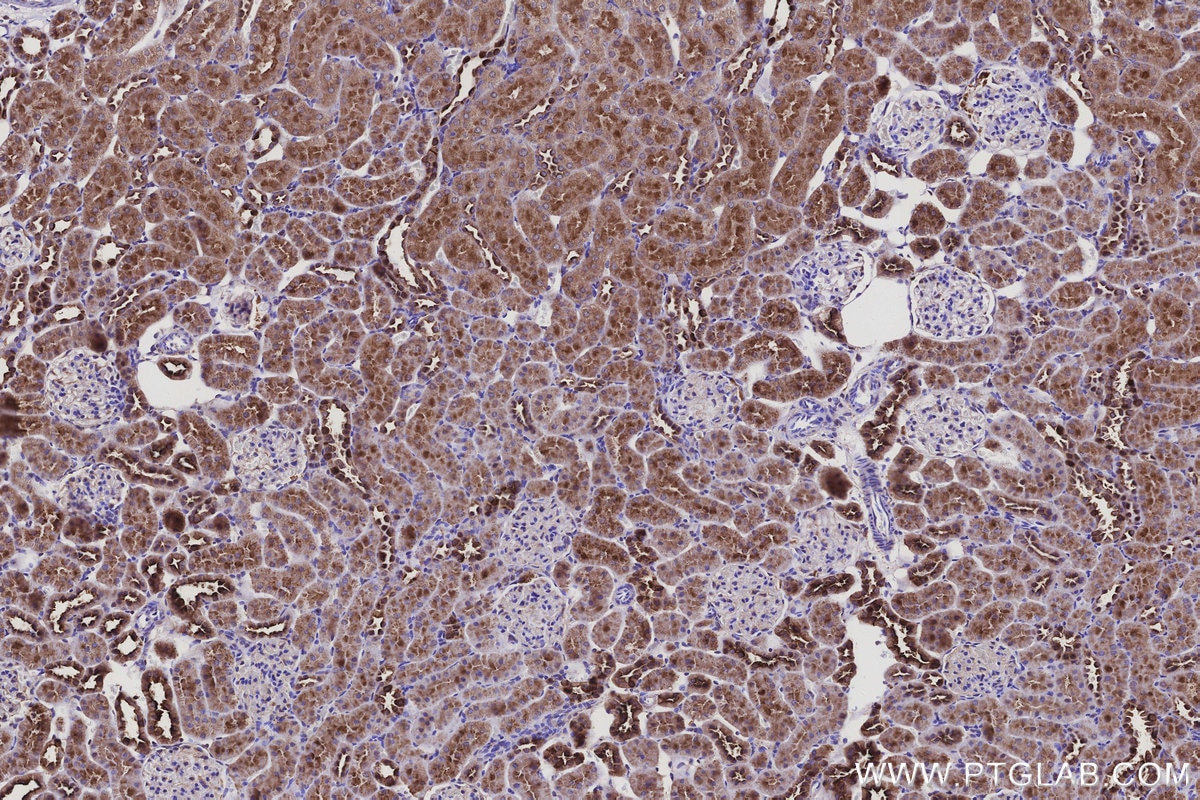 Immunohistochemistry (IHC) staining of rat kidney tissue using KIAA1468 Polyclonal antibody (18993-1-AP)