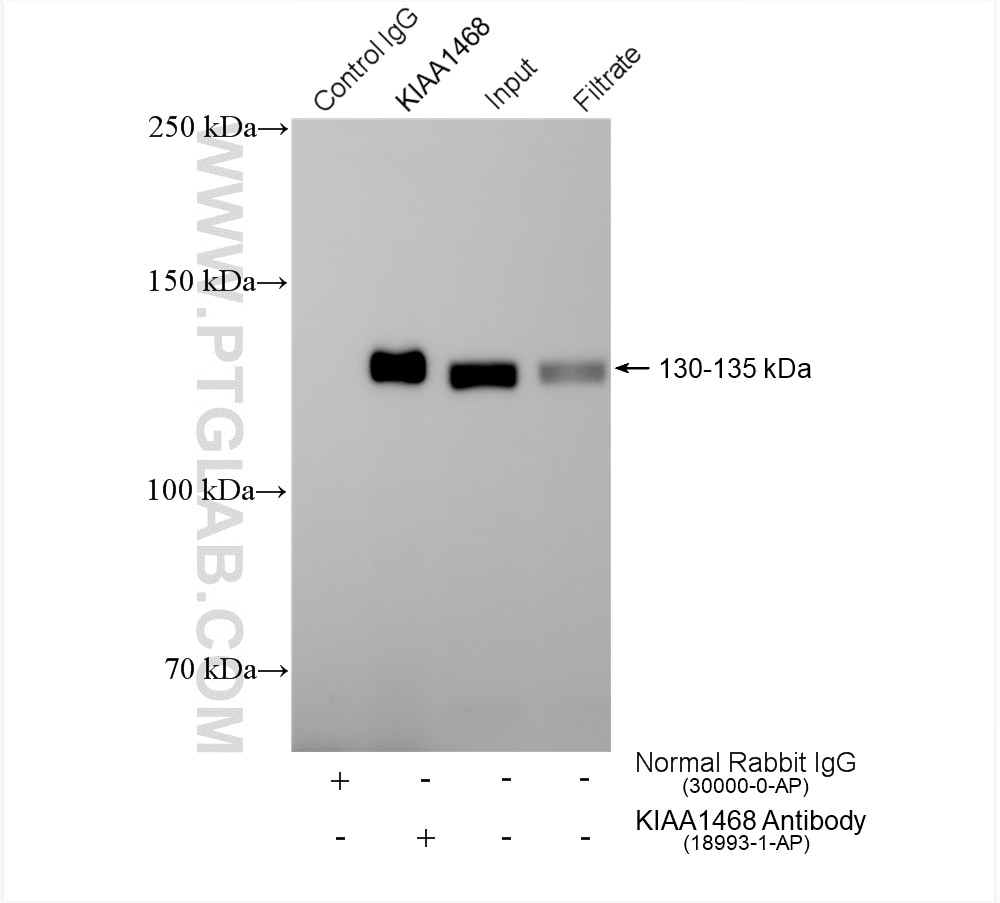 Immunoprecipitation (IP) experiment of mouse brain tissue using KIAA1468 Polyclonal antibody (18993-1-AP)